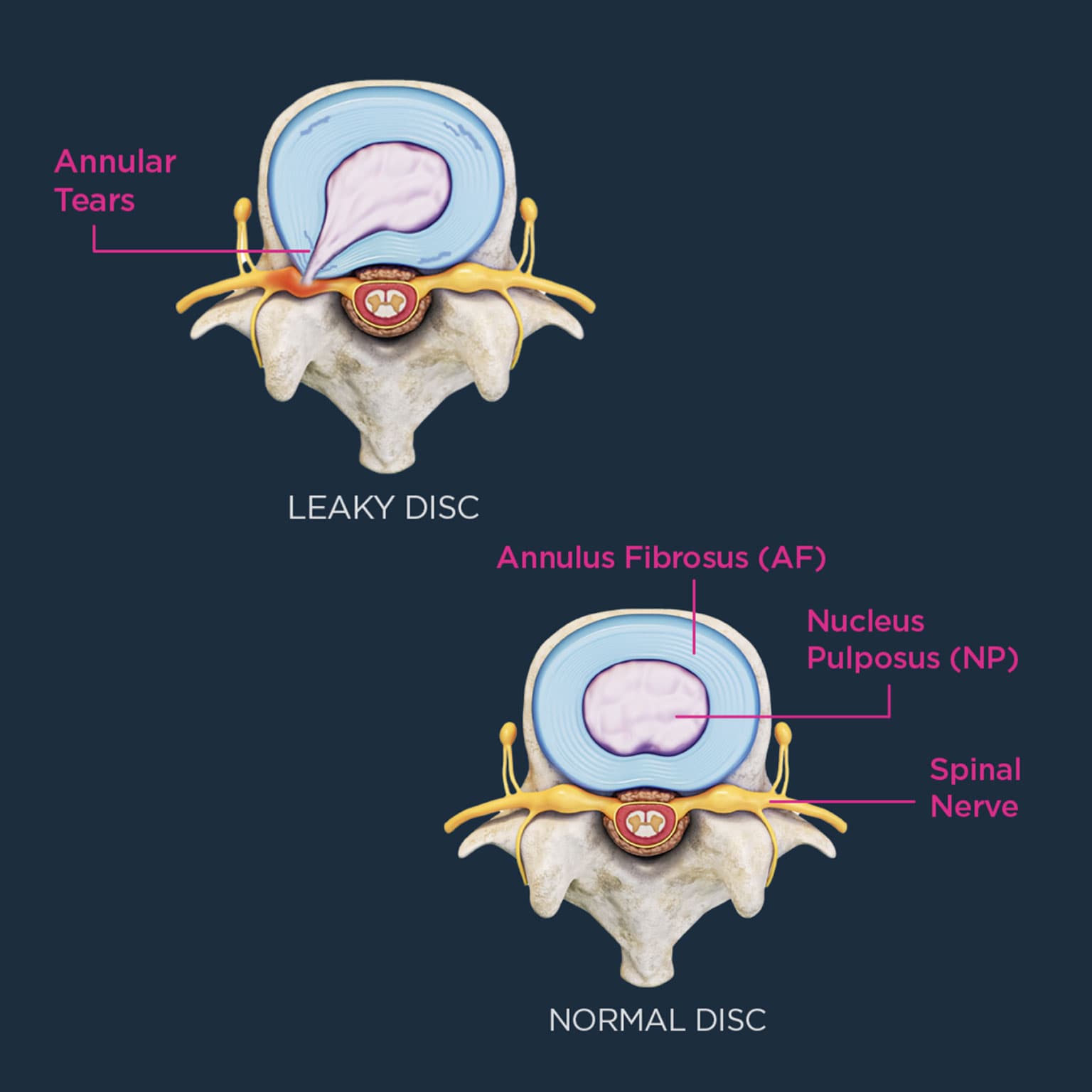 Total Medical non-surgical spine care